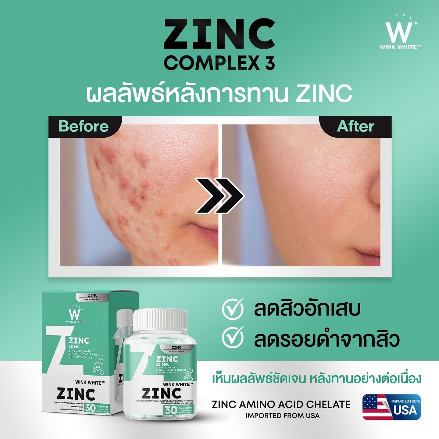 Wink White Zinc 15mg - 30 Capsules