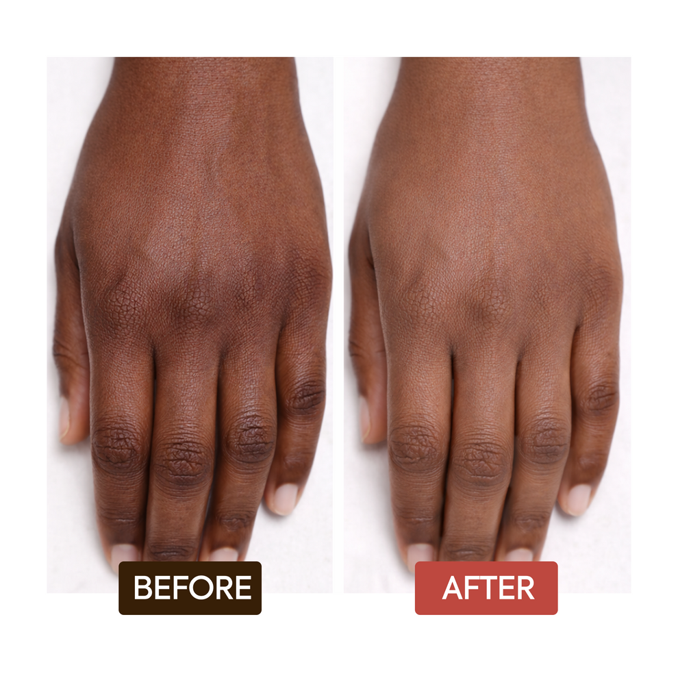 Makari Naturalle Intense Extreme Complexion Soap, 200g