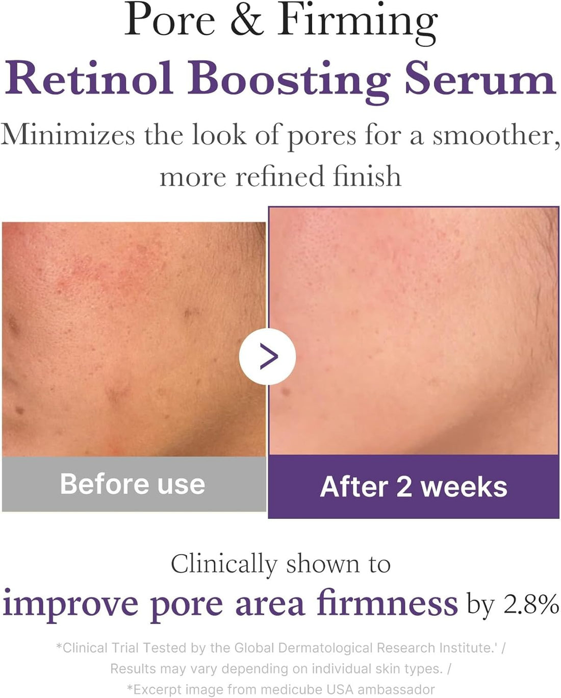 Medicube Retinol 1.9% NMN Boosting Serum (30 ml / 1.01 fl. oz.)
